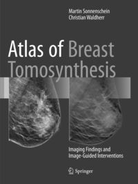 Produktbild: Atlas of Breast Tomosynthesis