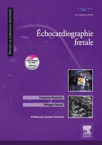 Produktbild: Echocardiographie Foetale