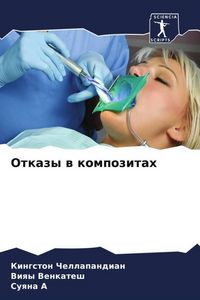 Produktbild: Otkazy w kompozitah