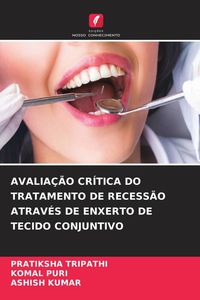 Produktbild: Avalia&ccedil;&atilde;o Cr&iacute;tica Do Tratamento De Recess&atilde;o Atrav&eacute;s De Enxerto De Tecido Conjuntivo