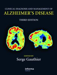 Produktbild: Clinical Diagnosis and Management of Alzheimer's Disease