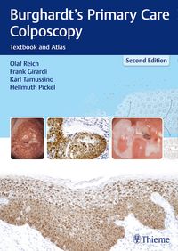 Produktbild: Burghardt's Primary Care Colposcopy