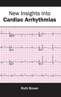 Produktbild: New Insights into Cardiac Arrhythmias