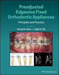 Produktbild: Preadjusted Edgewise Fixed Orthodontic Appliances