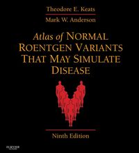 Produktbild: Atlas of Normal Roentgen Variants That May Simulate Disease E-Book