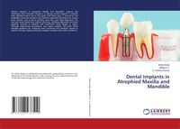 Produktbild: Dental Implants in Atrophied Maxilla and Mandible