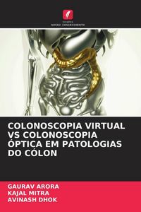 Produktbild: Colonoscopia Virtual Vs Colonoscopia &Oacute;ptica Em Patologias Do C&oacute;lon