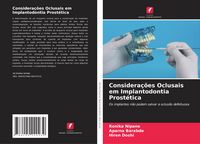 Produktbild: Considera&ccedil;&otilde;es Oclusais em Implantodontia Prost&eacute;tica