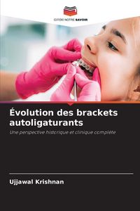 Produktbild: &Eacute;volution des brackets autoligaturants