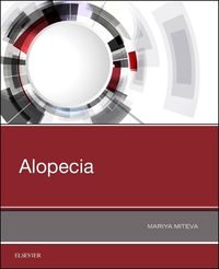Produktbild: Alopecia