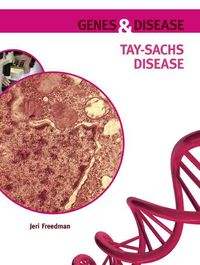 Produktbild: Tay-Sachs Disease