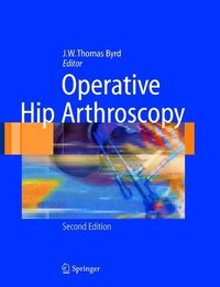 Produktbild: Operative Hip Arthroscopy 2/e