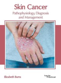 Produktbild: Skin Cancer: Pathophysiology, Diagnosis and Management