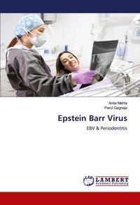 Produktbild: Epstein Barr Virus
