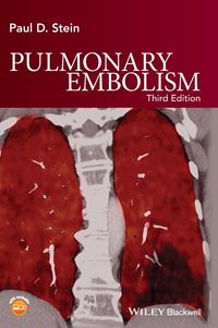 Produktbild: Pulmonary Embolism