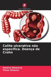 Produktbild: Colite ulcerativa n&atilde;o espec&iacute;fica. Doen&ccedil;a de Crohn
