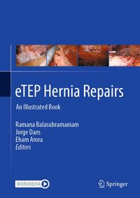 Produktbild: ETEP Hernia Repairs