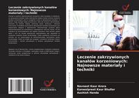 Produktbild: Leczenie zakrzywionych kana&iquest;&oacute;w korzeniowych: Najnowsze materia&iquest;y i techniki