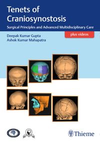 Bild vom Artikel Tenets of Craniosynostosis vom Autor 