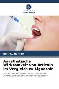 Produktbild: An&auml;sthetische Wirksamkeit von Articain im Vergleich zu Lignocain