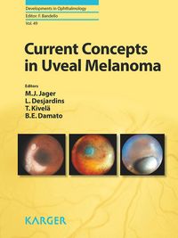 Produktbild: Current Concepts in Uveal Melanoma