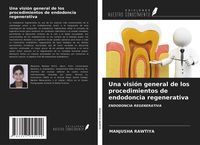 Produktbild: Una visi&oacute;n general de los procedimientos de endodoncia regenerativa