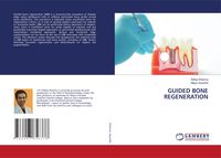 Produktbild: Guided Bone Regeneration