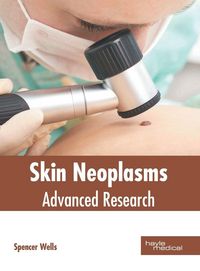 Produktbild: Skin Neoplasms: Advanced Research