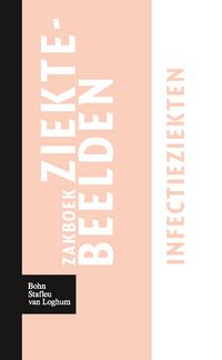 Produktbild: Zakboek ziektebeelden Infectieziekten