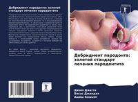 Produktbild: Debridment parodonta: zolotoj standart lecheniq parodontita