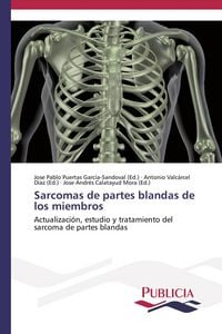 Produktbild: Sarcomas de partes blandas de los miembros