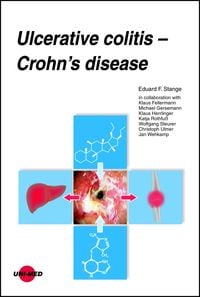 Produktbild: Ulcerative colitis - Crohn's disease