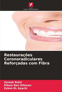 Produktbild: Restaura&ccedil;&otilde;es Coronoradiculares Refor&ccedil;adas com Fibra