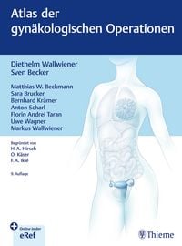 Produktbild: Atlas der gyn&auml;kologischen Operationen