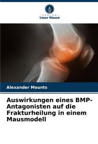 Produktbild: Auswirkungen eines BMP-Antagonisten auf die Frakturheilung in einem Mausmodell