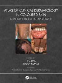 Produktbild: Atlas of Clinical Dermatology in Coloured Skin