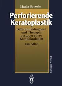 Produktbild: Perforierende Keratoplastik