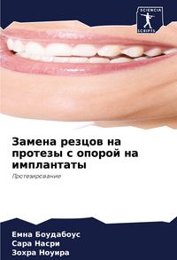 Produktbild: Zamena rezcow na protezy s oporoj na implantaty