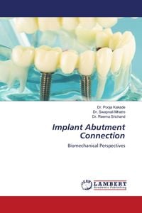 Produktbild: Implant Abutment Connection