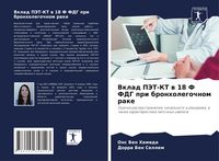 Produktbild: Vklad PJeT-KT w 18 F FDG pri bronholegochnom rake