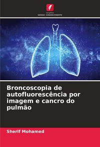 Produktbild: Broncoscopia de autofluoresc&ecirc;ncia por imagem e cancro do pulm&atilde;o