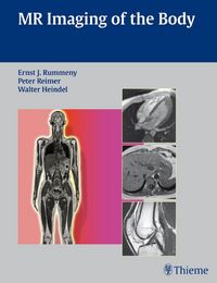 Produktbild: MR Imaging of the Body