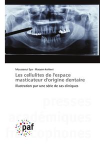 Produktbild: Les cellulites de l'espace masticateur d'origine dentaire