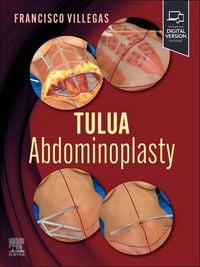 Produktbild: Tulua Abdominoplasty