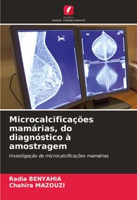 Produktbild: Microcalcifica&ccedil;&otilde;es mam&aacute;rias, do diagn&oacute;stico &agrave; amostragem