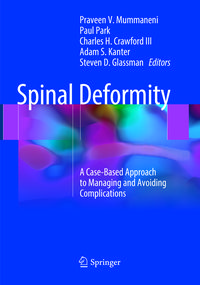 Produktbild: Spinal Deformity