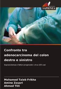 Produktbild: Confronto tra adenocarcinoma del colon destro e sinistro