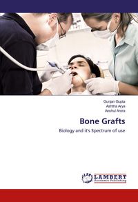 Produktbild: Bone Grafts