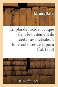 Produktbild: De l'Emploi de l'Acide Lactique Dans Le Traitement de Certaines Ulc&eacute;rations Tuberculeuses