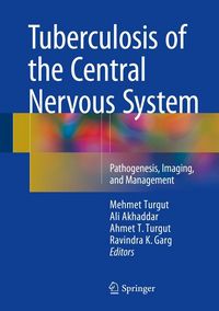 Produktbild: Tuberculosis of the Central Nervous System
